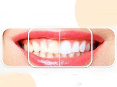 Best dental clinic in Kolkata